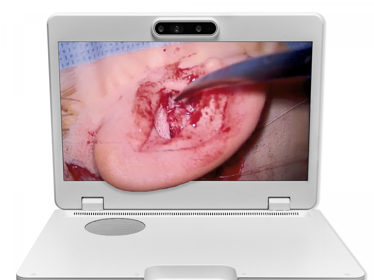 达擎之＂Heads-up 3D显微手术显示系统＂，整合4K裸眼3D显示及眼球追踪系统，具备快速追踪人眼移动位置功能，减轻医师长时间维持固定姿势的负担，让医师能有更宽广清晰的3D立体视野及更舒适的姿势来执行手术。